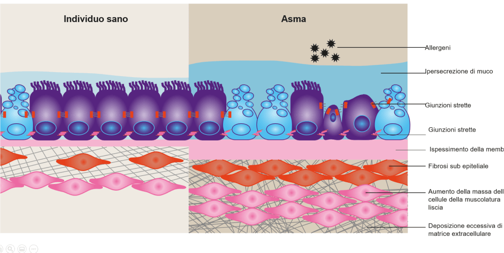 Epitelioasma